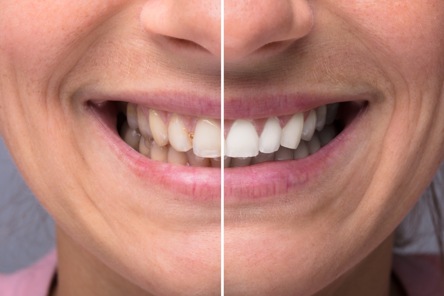 how cosmetic dentistry