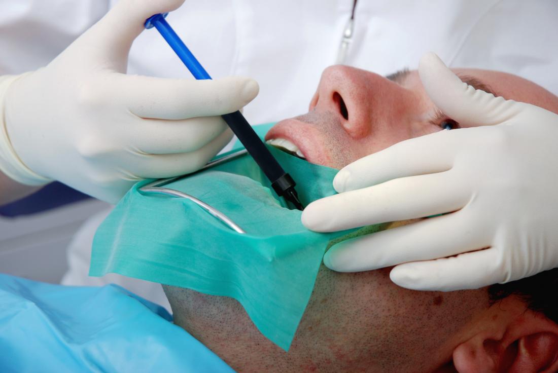 root canal therapy saves your natural tooth